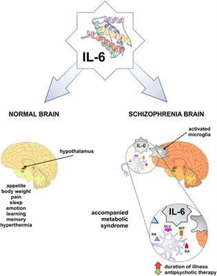 Interleukin-6 in Schizophrenia—Is There a Therapeutic Relevance?